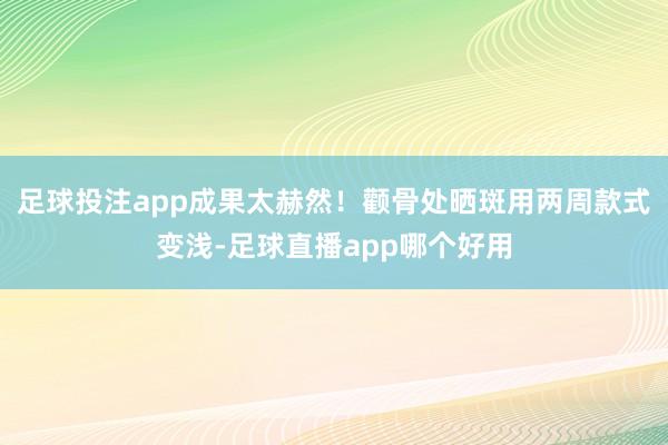 足球投注app成果太赫然！颧骨处晒斑用两周款式变浅-足球直播app哪个好用